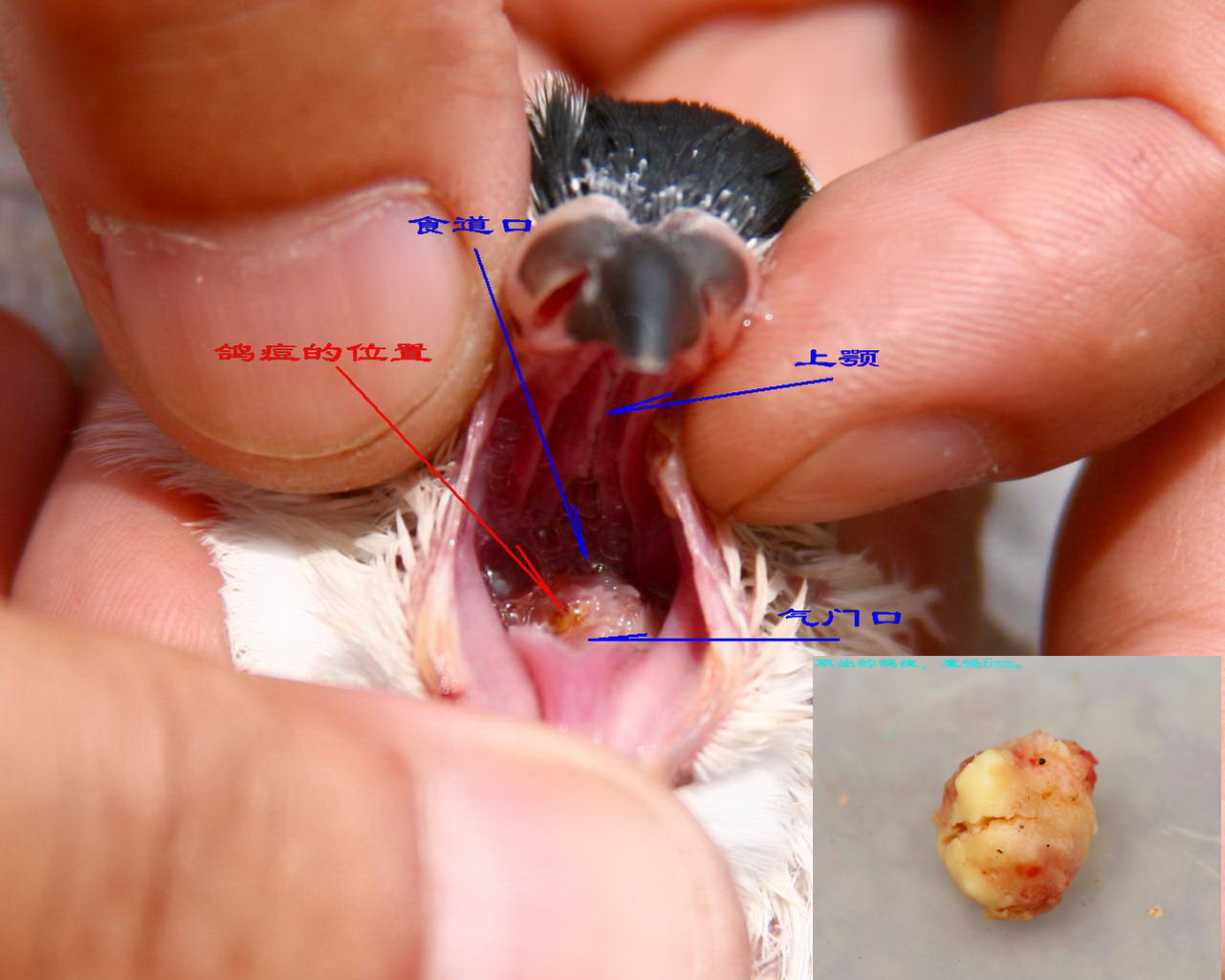 <em>妹夫</em>才33,肝硬化晚期有少量腹水,大家帮忙出出